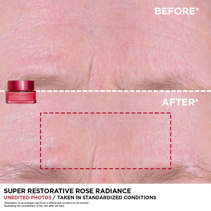 Clarins Rose Radiance Super Restorative 50 ml dagcreme før og efter resultat af glattere hud i panden
