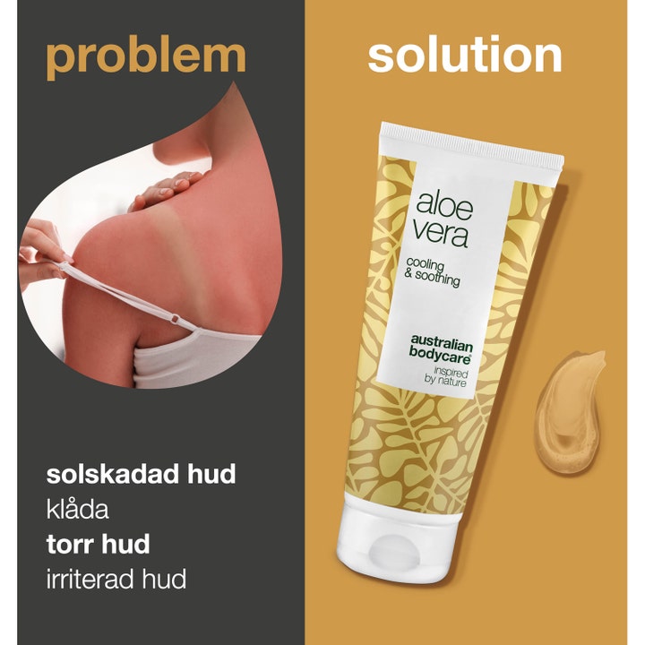 Australian Bodycare Aloe Vera Gel 100 ml kølende gel til irriteret hud vist med solskoldet skulder og hvid tube.