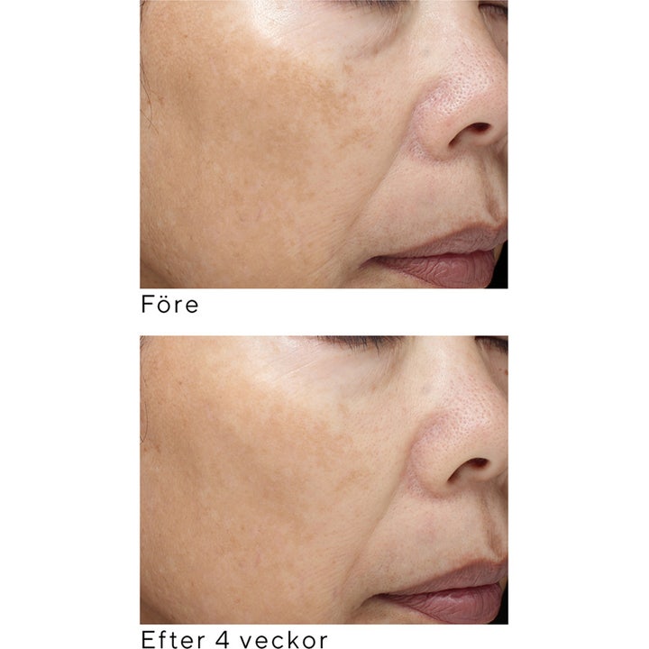 Murad Essential-C Firming Radiance Day Cream 50 ml mod pigmentering viser før og efter resultater på huden.