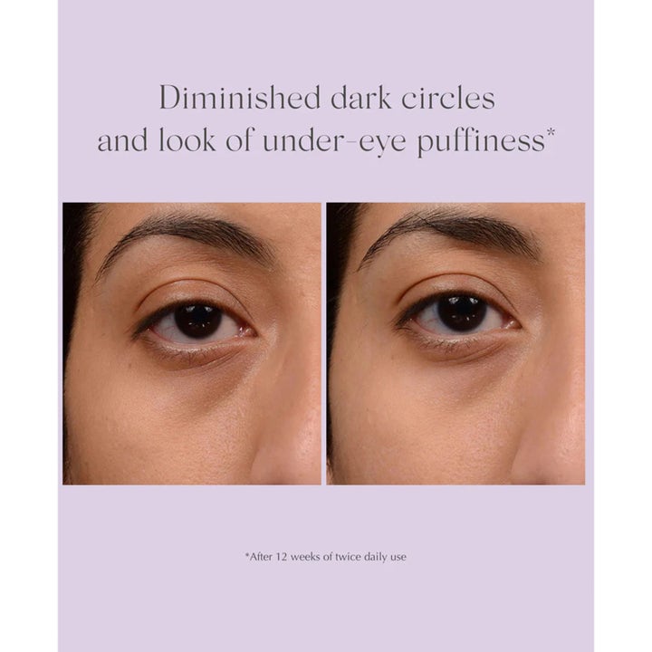 Exuviance Bright Eyes Dark Circle Corrector 15 g øjencreme viser før og efter resultat på mørke rande