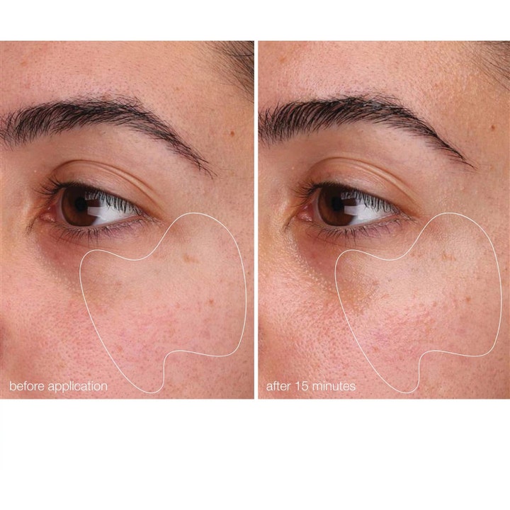 Dermalogica BioLumin-C Gel Moisturizer 50 ml C-vitamin ansigtscreme før og efter resultat på huden efter 15 minutter