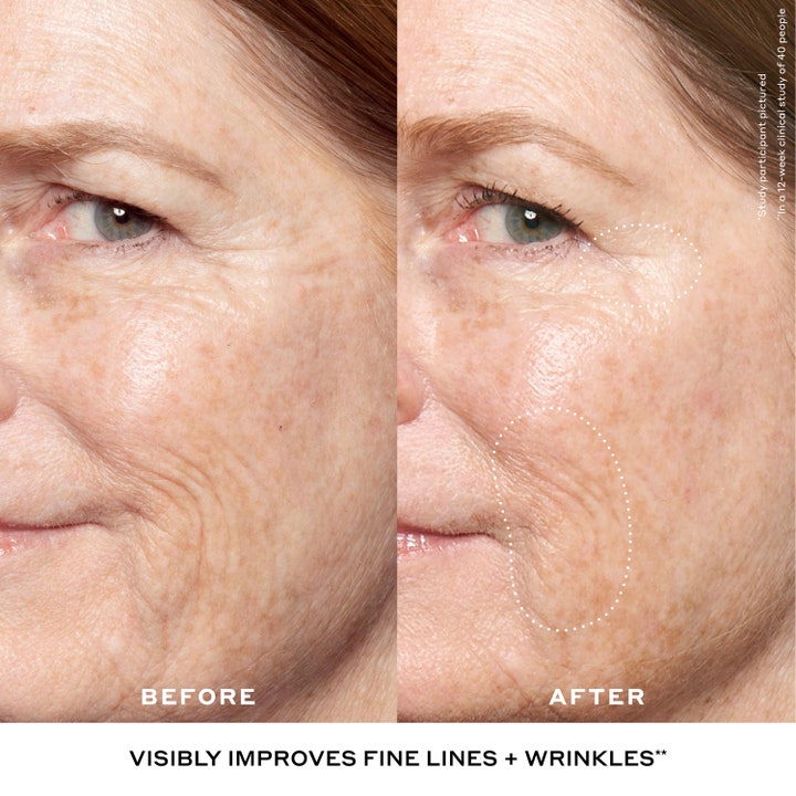 Ole Henriksen Double Rewind Retinol Serum 30 ml før og efter resultat der reducerer synlige rynker og linjer
