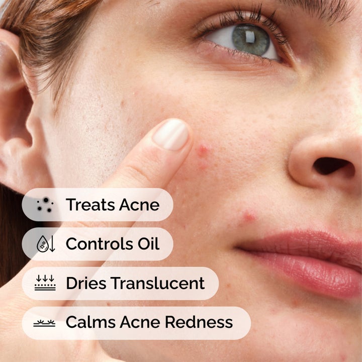 The Ordinary Sulfur 10% Powder-To-Cream Concentrate 5 g spot treatment mod acne dæmper rødme og kontrollerer olie.