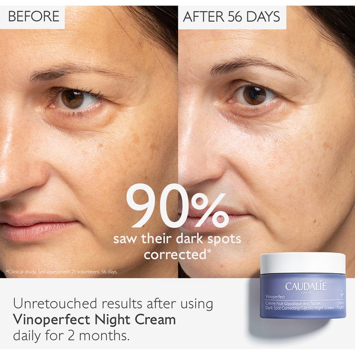 Caudalie Vinoperfect Night Cream 50 ml natcreme mod pigmentpletter viser 90 % korrektion i før og efter billede.