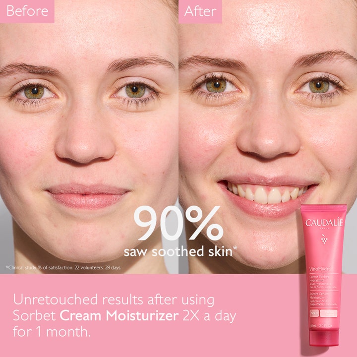 Caudalie Vinohydra Sorbet Cream Moisturizer 60 ml beroligende ansigtscreme før og efter brug på en kvinde