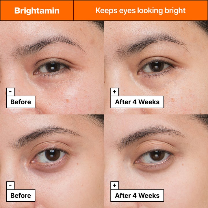 Dr.Jart+ Brightamin Brightening Eye Serum Stick 3,6 g øjencreme før og efter resultat efter 4 uger