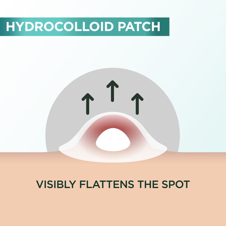 Garnier PureActive Invisible Pimple Patch 22 stk spot treatment infografik af hydrocolloid plaster der udjævner bumser.
