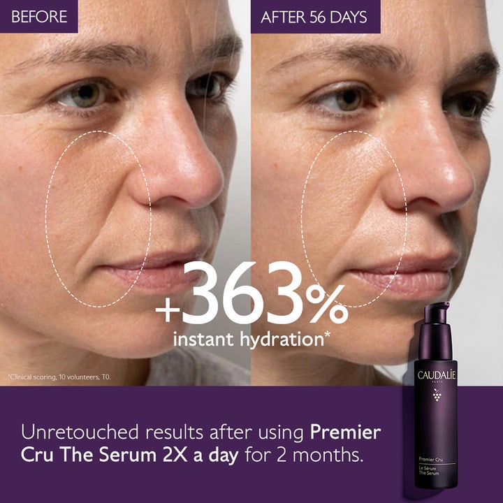 Caudalie The Serum 30 ml før og efter resultat der giver fugt og reducerer rynker ved munden