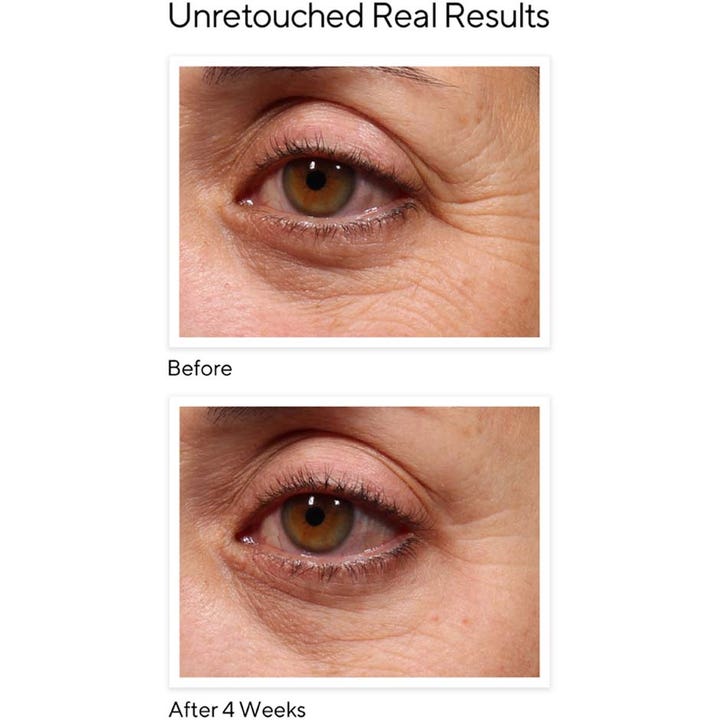Murad Resurgence Retinol Youth Renewal Eye Serum 15 ml øjenserum viser før og efter resultater på rynker efter 4 uger