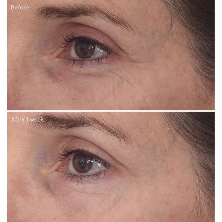Murad Retinal ReSculpt Eye Lift Treatment 15 ml øjencreme viser før og efter resultater på rynker efter en uge