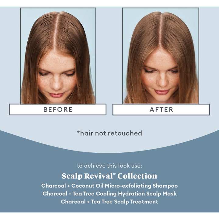 Scalp Revival™ Scalp Soothing Solutions Set
