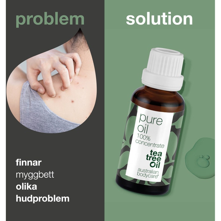 Australian Bodycare Pure Oil 100% Tea Tree Oil 30 ml mod uren hud i brun flaske vist som løsning på kløe