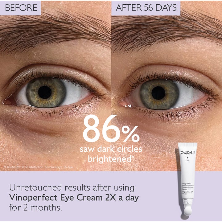 Caudalie Vinoperfect Brightening Eye Cream 15 ml viser før og efter resultat mod mørke rande efter 56 dages brug.