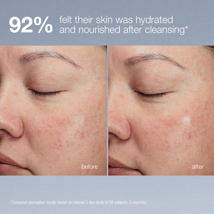 Dermalogica Magnetic Afterglow Cleanser Duo ansigtsrens før og efter resultat af fugtet hud med 92% effekt