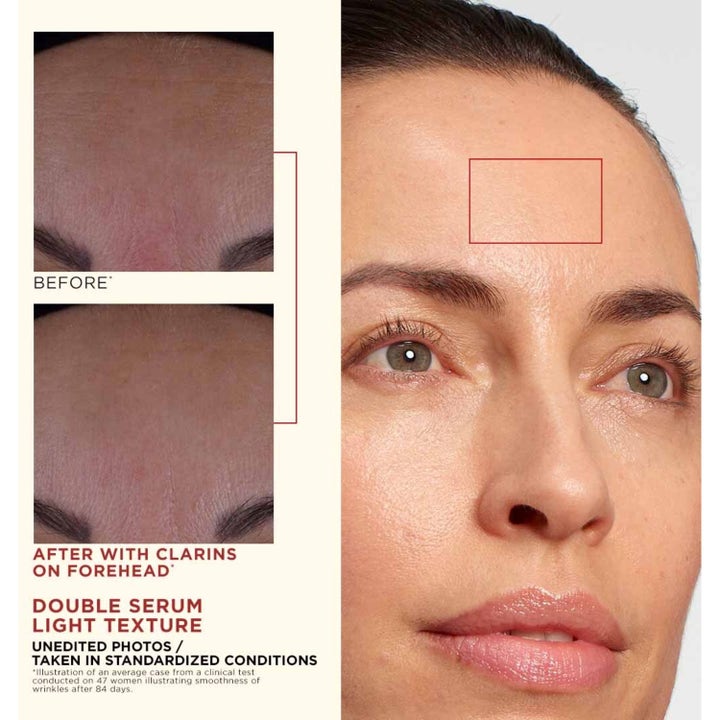 Clarins Double Serum Light Texture 50 ml udglattende serum viser før og efter resultat på panderynker.