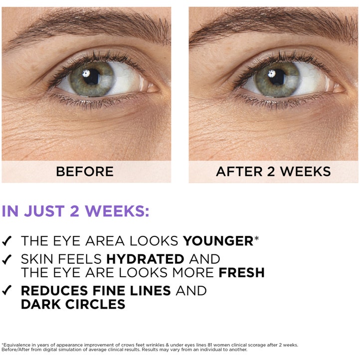 L'Oréal Paris Filler Eye Serum 20 ml øjenserum viser før- og efterresultat på rynker og mørke rande efter 2 uger.