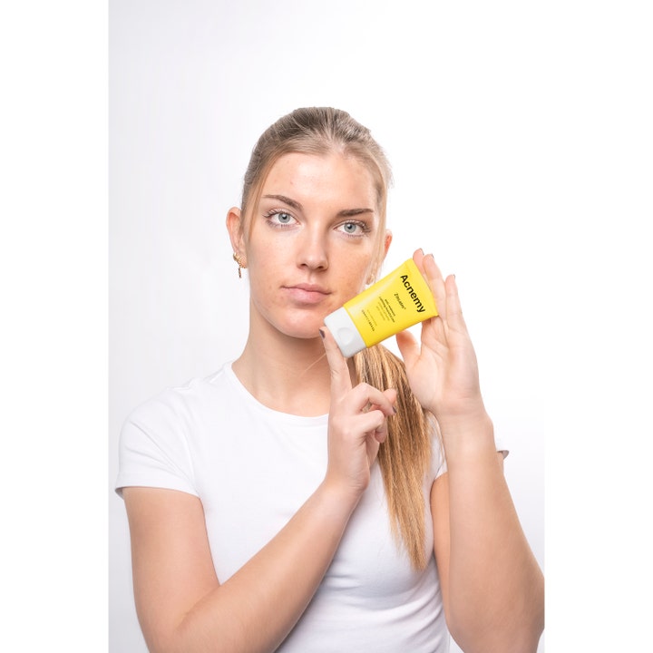 Niche Beauty Lab Acnemy Zitcalm 50 ml ansigtscreme holdt af en person i lifestyle-miljø