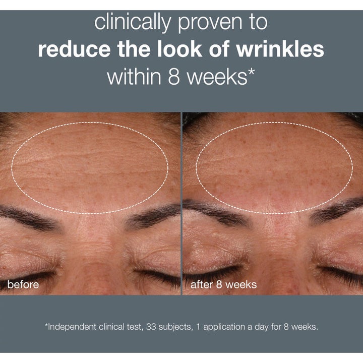 Dermalogica AGE smart Duo Dynamic Skin Recovery SPF50 anti-age hudpleje før og efter resultat på rynker i panden