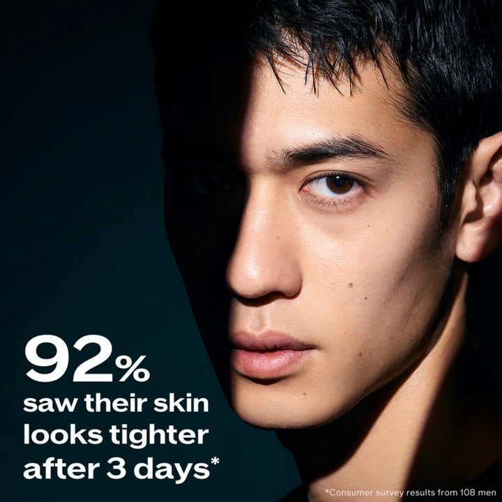 Shiseido Ultimune Men 2.0 Power Infusing Concentrate 50 ml serum giver fastere hud efter 3 dage på en mand.