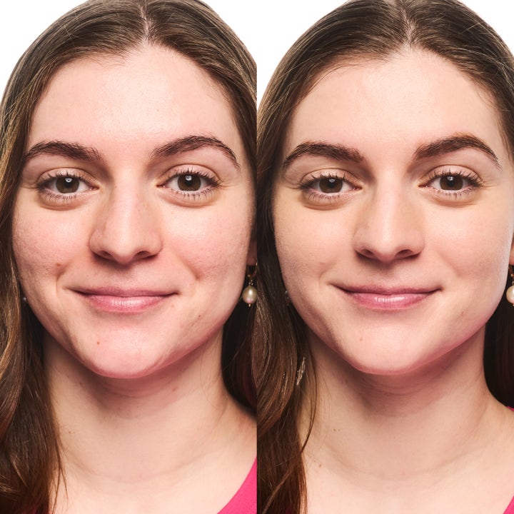 Foundation Stick