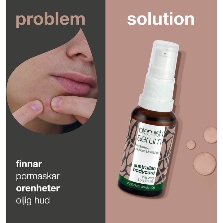 Australian Bodycare Blemish Serum 30 ml mod uren hud med tea tree oil og niacinamid i brun glasflaske