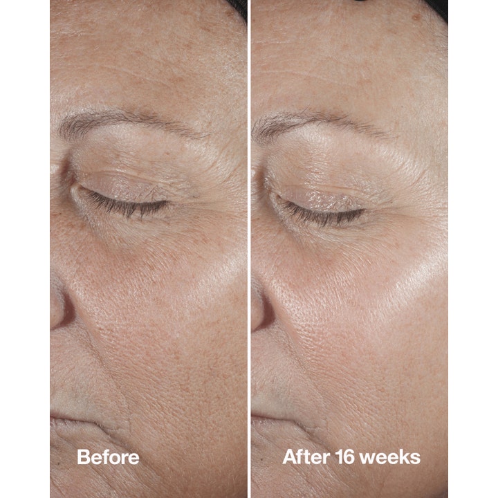 Clinique Smart Clinical Repair Wrinkle Correcting Serum 30 ml rynkekorrigerende serum før og efter 16 ugers resultat.