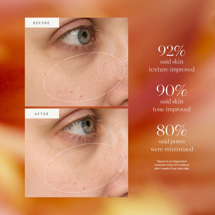 KORA Organics Turmeric Glow Drops 30 ml serum før og efter resultater på hudtekstur og porer