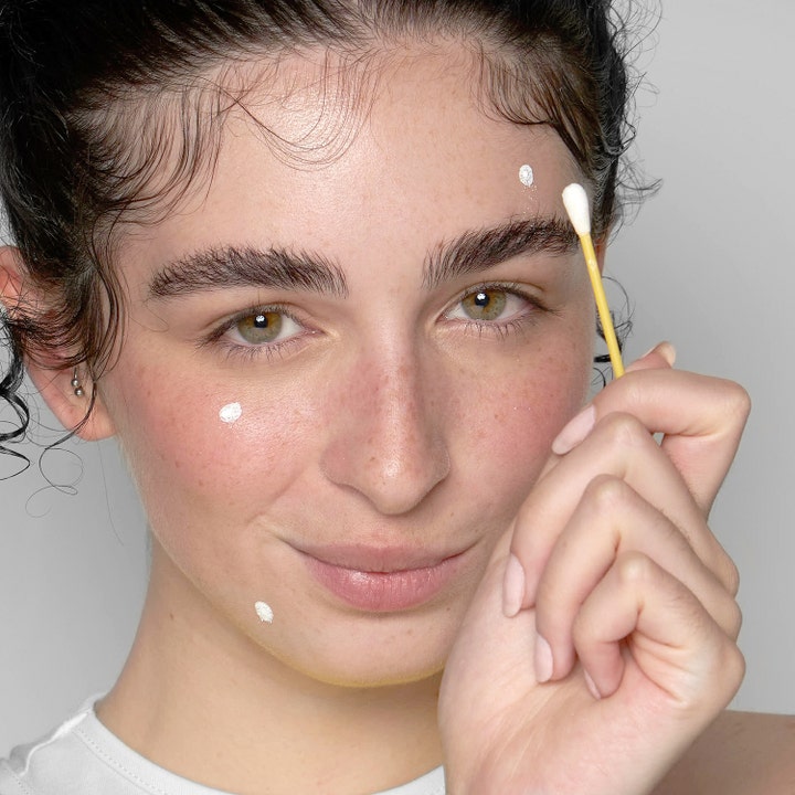 Niche Beauty Lab Acnemy Dryzit 30 ml spot treatment mod urenheder påført som hvide prikker med en vatpind