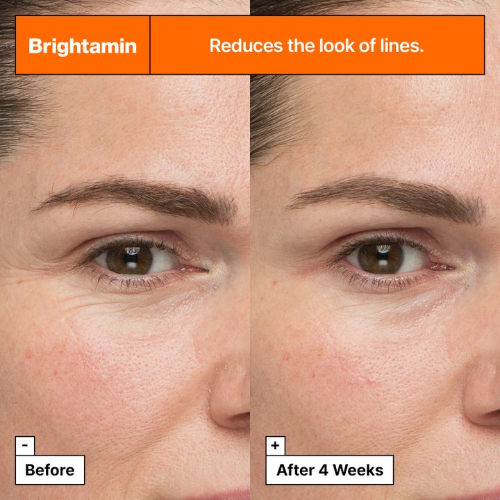 Dr.Jart+ Brightamin Brightening Serum Ampoule 8,08 g før og efter resultat der reducerer fine linjer.