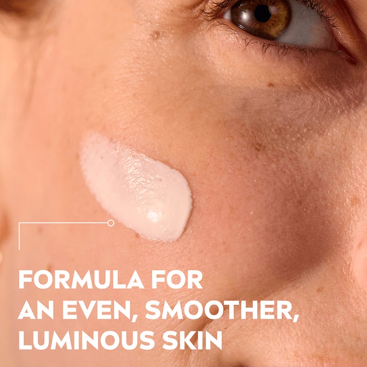 NIVEA LUMINOUS 630 Post-Acne Marks Serum 30 ml mod pigmentpletter med let tekstur på huden for en jævn glød