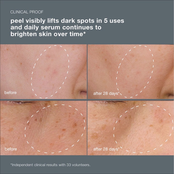 Dermalogica PowerBright Dark Spot System mod pigmentpletter med før og efter resultater der lysner huden på 28 dage