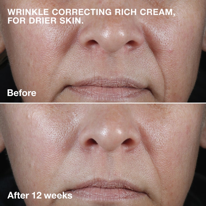 Clinique Smart Clinical Repair Wrinkle Face Cream Rich 50 ml ansigtscreme mod rynker før og efter 12 uger