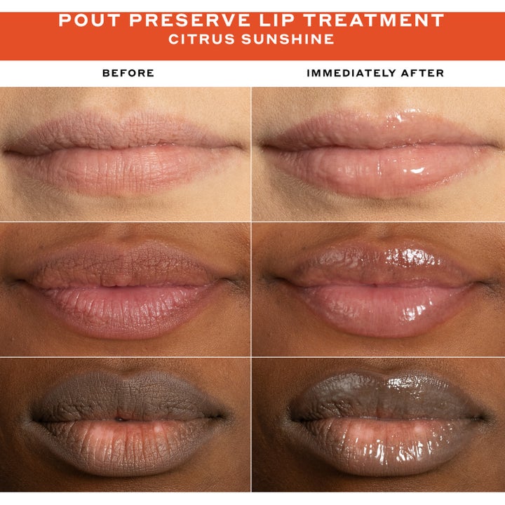 Clinical Quick Fix Mini Set