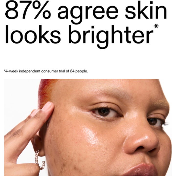 The INKEY List 15% Vitamin C and EGF Serum 30 ml lysnende serum på model med tekst 87% agree skin looks brighter