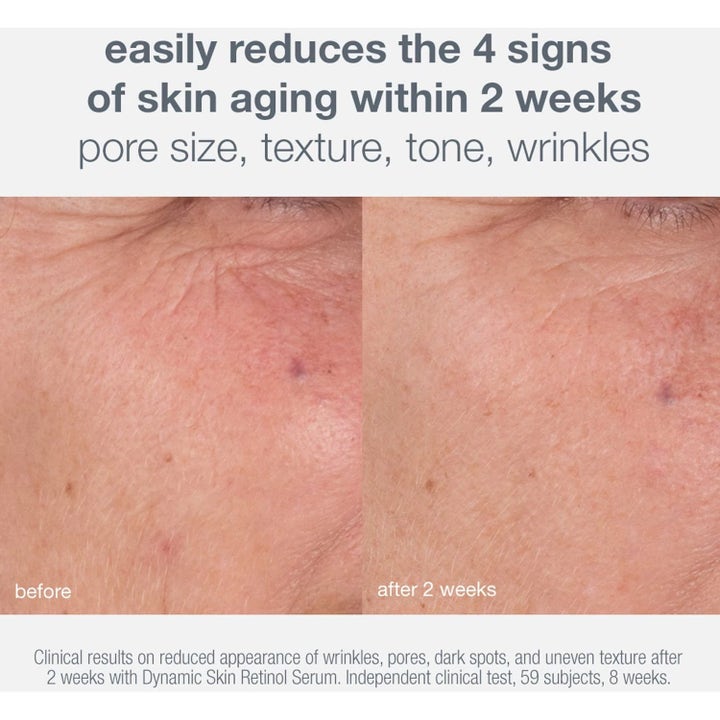 Dermalogica Skin Aging Solutions Duo hudpleje før og efter resultater der reducerer rynker og porer på to uger.