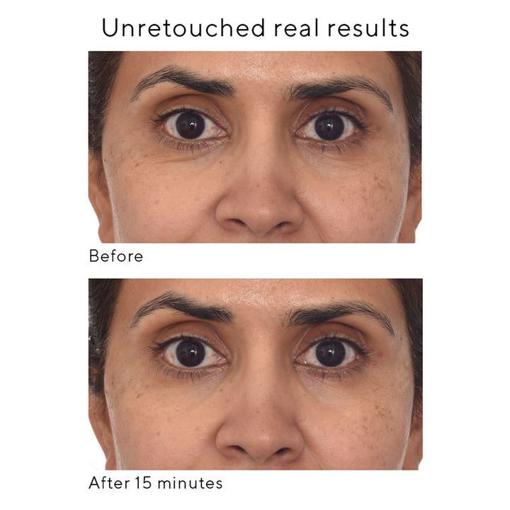 Murad Retinol Youth Renewal Eye Mask 5 stk øjenmasker viser før og efter resultater på rynker efter 15 minutter