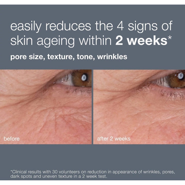 Dermalogica Dynamic Skin Retinol Serum 30 ml før og efter billeder der viser færre rynker og finere tekstur