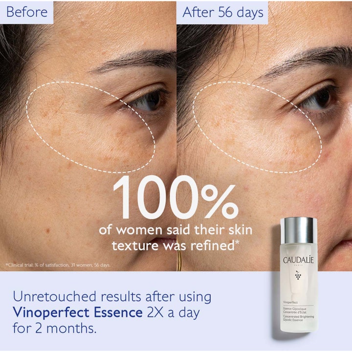 Caudalie Vinoperfect Concentrated Glycolic Essence 100 ml giver jævnere hudstruktur vist med før og efter resultater