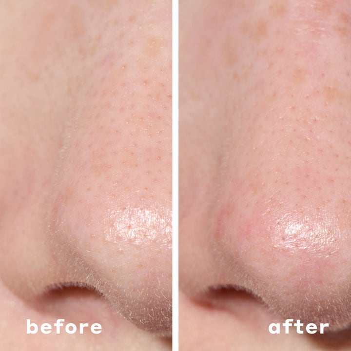 Mario Badescu 2-In-1 Deep Cleansing Pore Strip 6 stk. dybderensende pleje viser før og efter resultat på næsen.