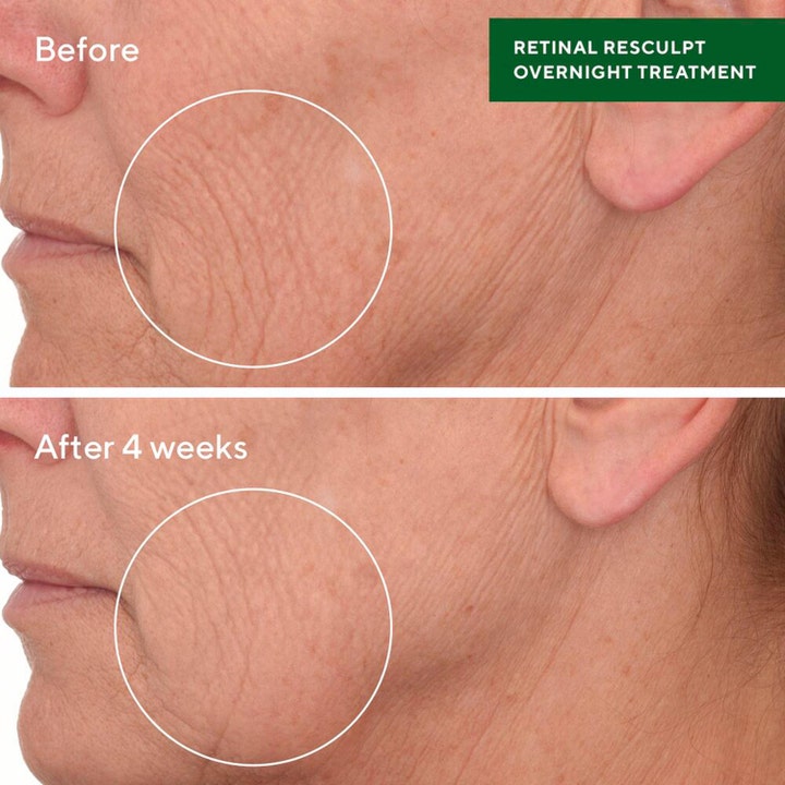 Murad Retinal ReSculpt Treatment 30 ml serum mod rynker viser synlige før og efter resultater efter 4 uger