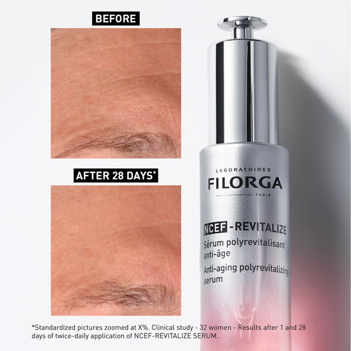 Filorga NCEF-Revitalize Serum 30 ml revitaliserende serum viser før og efter resultater ved siden af sølvflasken