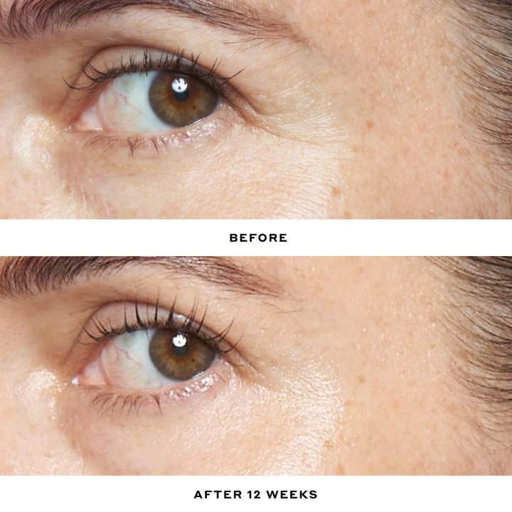 Ole Henriksen Double Rewind Pro-Grade 0.3% Retinol Serum 30 ml før og efter resultat mod rynker ved øjet