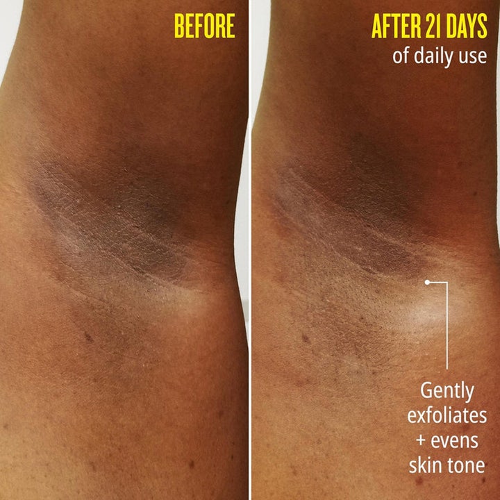 Sol de Janeiro Rio Deo 62 Aluminum-Free Deodorant 57 g der eksfolierer blidt og udjævner hudtonen efter 21 dages brug.