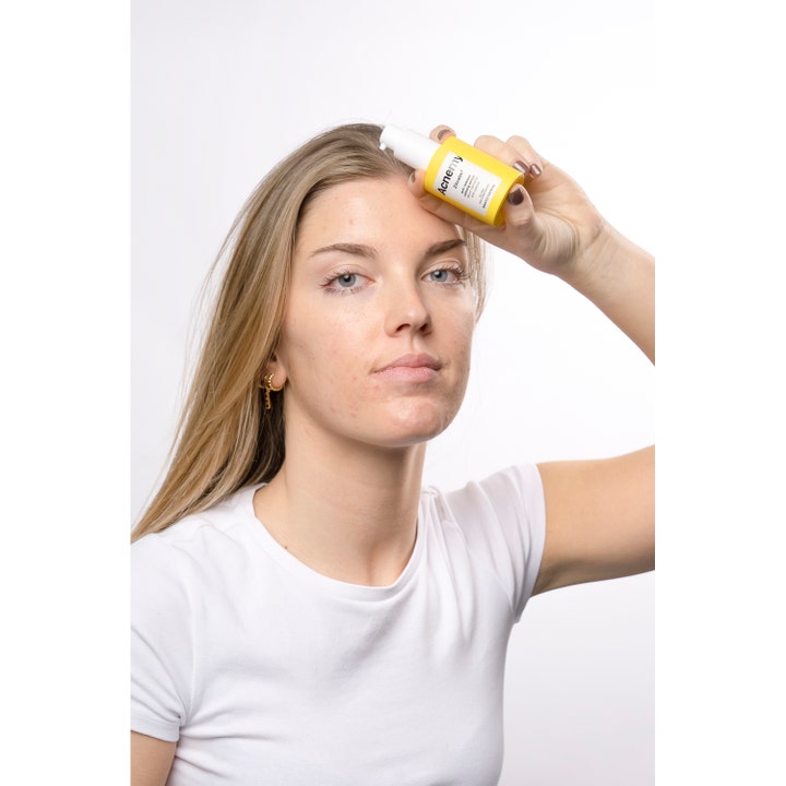 Niche Beauty Lab Acnemy Zitcalm Serum 30 ml beroligende ansigtsserum i gul flaske holdt mod panden