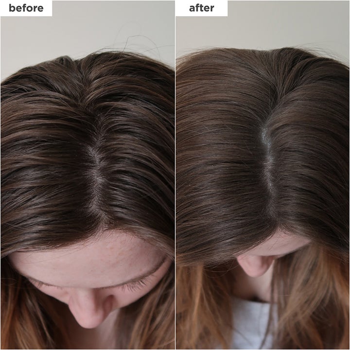 Scalp Revival™ Dry Shampoo