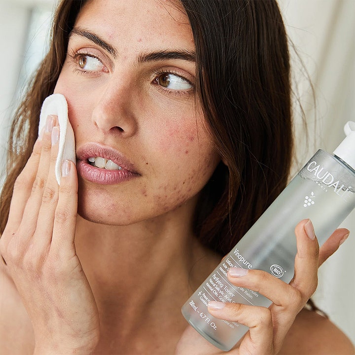 Caudalie Vinopure Purifying Toner 200 ml mod urenheder anvendes af kvinde med vatrondel på huden