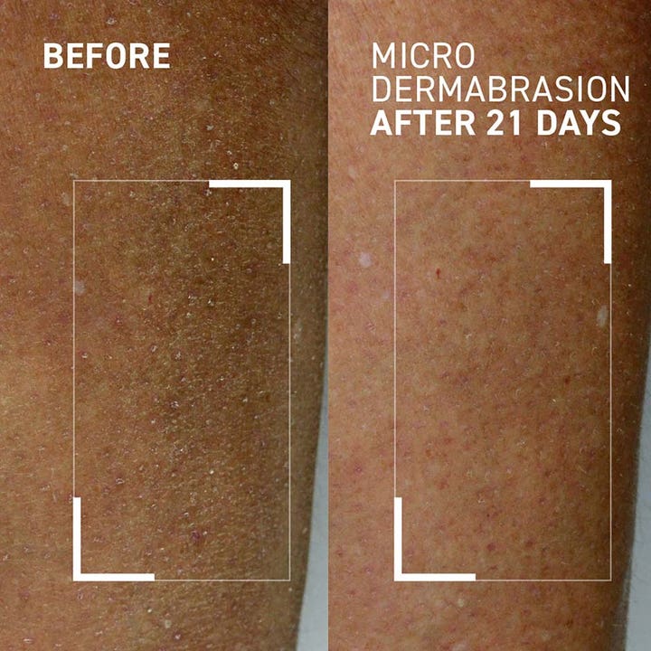 Dr Brandt Microdermabrasion Body Exfoliator 100 g body scrub viser før og efter 21 dages brug på hudens tekstur.
