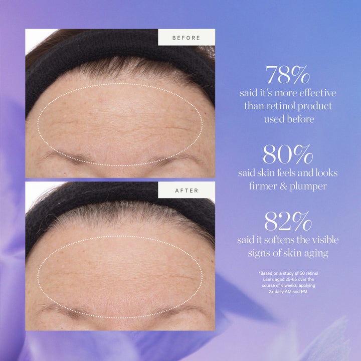 KORA Organics Plant Stem Cell Retinol Alternative Serum 10 ml viser før og efter resultater på rynker i panden