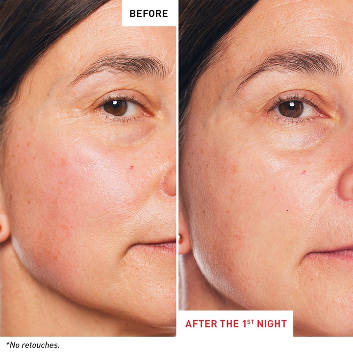 Erborian Skin Therapy Night Oil Serum 30 ml natserum før og efter resultat der viser synligt glattere hud