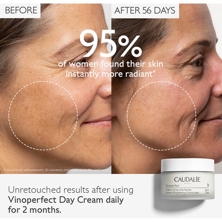 Caudalie Vinoperfect Instant Brightening Moisturizer 50 ml dagcreme før og efter resultat mod pigmentpletter